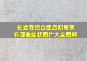 帕金森综合症后期表现有哪些症状图片大全图解