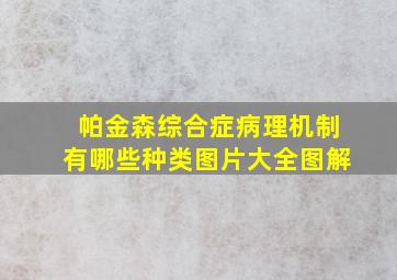 帕金森综合症病理机制有哪些种类图片大全图解