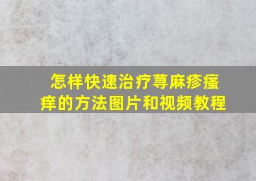 怎样快速治疗荨麻疹瘙痒的方法图片和视频教程