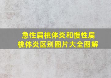 急性扁桃体炎和慢性扁桃体炎区别图片大全图解