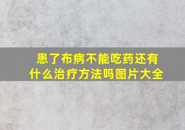 患了布病不能吃药还有什么治疗方法吗图片大全