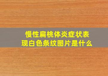 慢性扁桃体炎症状表现白色条纹图片是什么