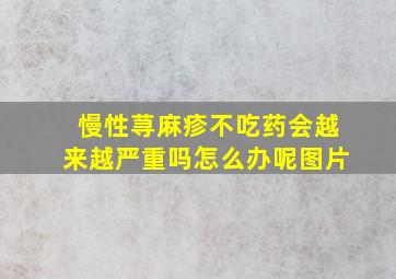 慢性荨麻疹不吃药会越来越严重吗怎么办呢图片