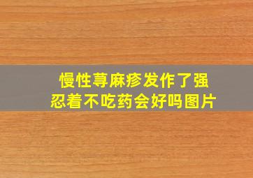 慢性荨麻疹发作了强忍着不吃药会好吗图片