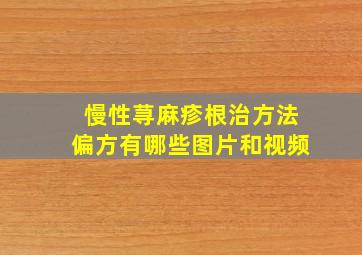 慢性荨麻疹根治方法偏方有哪些图片和视频