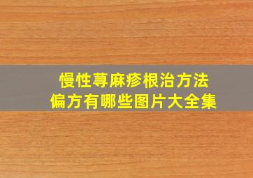 慢性荨麻疹根治方法偏方有哪些图片大全集