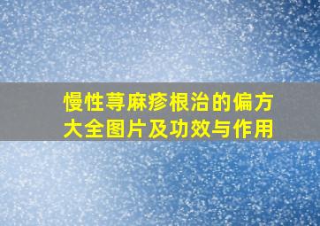 慢性荨麻疹根治的偏方大全图片及功效与作用