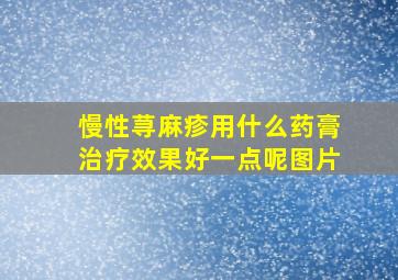 慢性荨麻疹用什么药膏治疗效果好一点呢图片