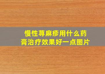 慢性荨麻疹用什么药膏治疗效果好一点图片