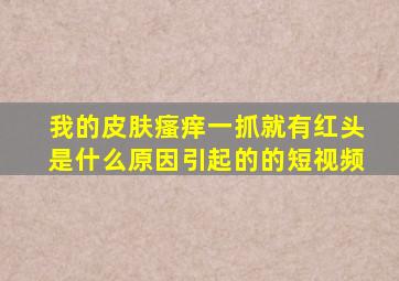 我的皮肤瘙痒一抓就有红头是什么原因引起的的短视频