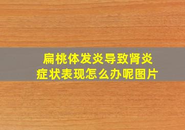 扁桃体发炎导致肾炎症状表现怎么办呢图片