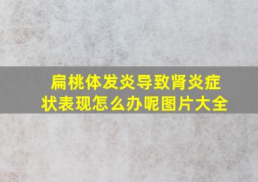 扁桃体发炎导致肾炎症状表现怎么办呢图片大全