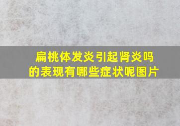 扁桃体发炎引起肾炎吗的表现有哪些症状呢图片