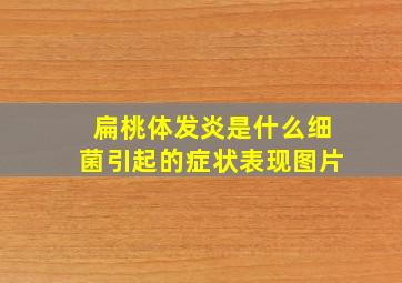 扁桃体发炎是什么细菌引起的症状表现图片