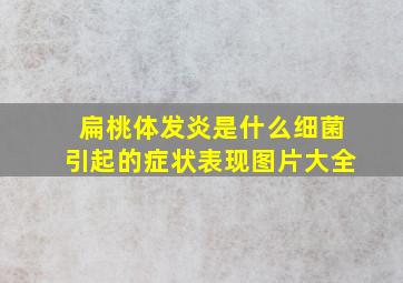 扁桃体发炎是什么细菌引起的症状表现图片大全