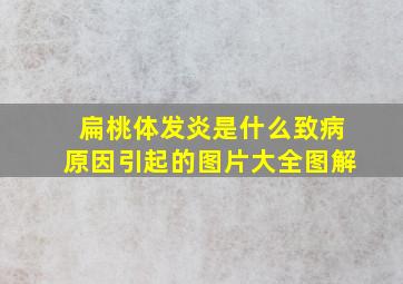 扁桃体发炎是什么致病原因引起的图片大全图解