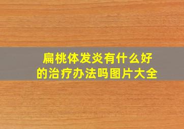 扁桃体发炎有什么好的治疗办法吗图片大全