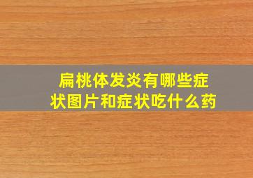 扁桃体发炎有哪些症状图片和症状吃什么药