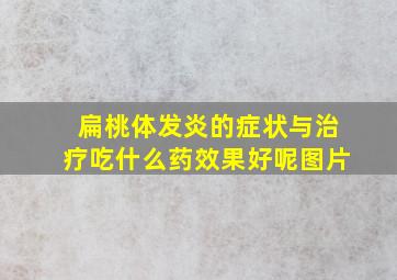 扁桃体发炎的症状与治疗吃什么药效果好呢图片