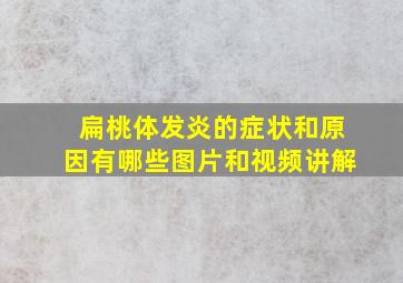 扁桃体发炎的症状和原因有哪些图片和视频讲解