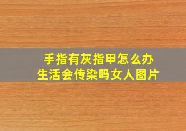 手指有灰指甲怎么办生活会传染吗女人图片