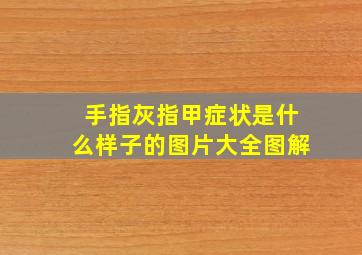 手指灰指甲症状是什么样子的图片大全图解