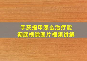 手灰指甲怎么治疗能彻底根除图片视频讲解