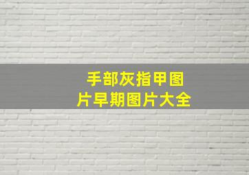 手部灰指甲图片早期图片大全