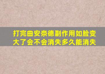 打完曲安奈德副作用如脸变大了会不会消失多久能消失