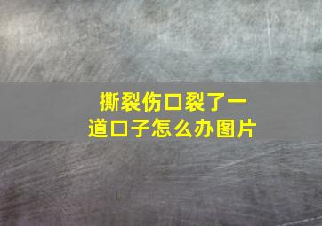 撕裂伤口裂了一道口子怎么办图片