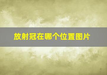 放射冠在哪个位置图片