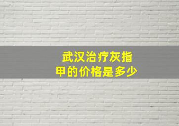 武汉治疗灰指甲的价格是多少