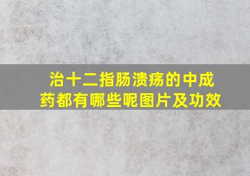 治十二指肠溃疡的中成药都有哪些呢图片及功效