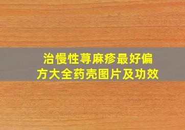 治慢性荨麻疹最好偏方大全药壳图片及功效