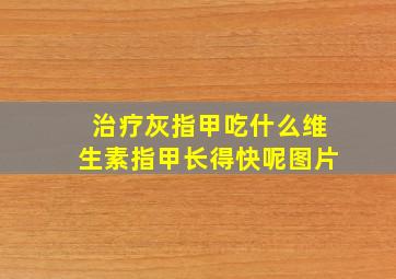 治疗灰指甲吃什么维生素指甲长得快呢图片