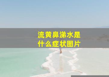 流黄鼻涕水是什么症状图片