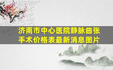 济南市中心医院静脉曲张手术价格表最新消息图片