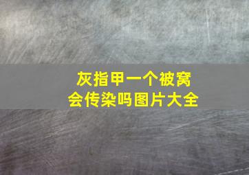 灰指甲一个被窝会传染吗图片大全