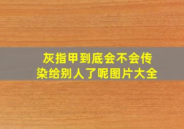 灰指甲到底会不会传染给别人了呢图片大全