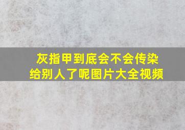 灰指甲到底会不会传染给别人了呢图片大全视频