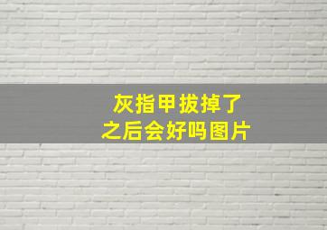 灰指甲拔掉了之后会好吗图片