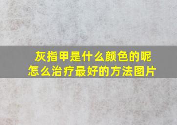 灰指甲是什么颜色的呢怎么治疗最好的方法图片