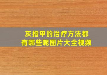 灰指甲的治疗方法都有哪些呢图片大全视频