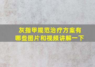 灰指甲规范治疗方案有哪些图片和视频讲解一下