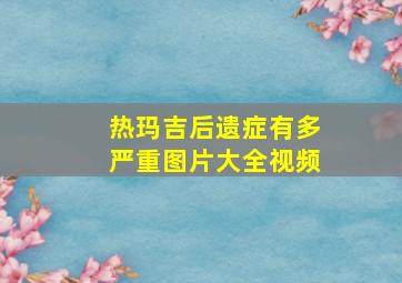 热玛吉后遗症有多严重图片大全视频