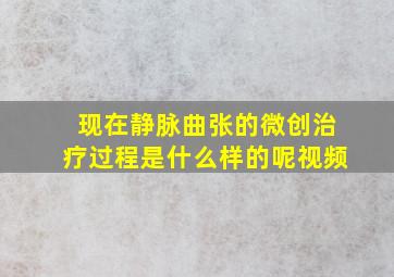 现在静脉曲张的微创治疗过程是什么样的呢视频