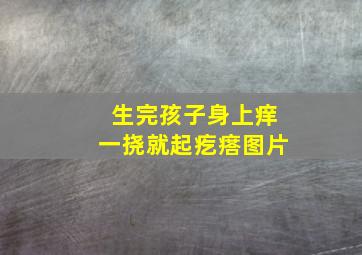 生完孩子身上痒一挠就起疙瘩图片