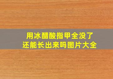 用冰醋酸指甲全没了还能长出来吗图片大全