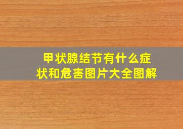 甲状腺结节有什么症状和危害图片大全图解