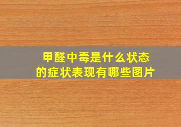 甲醛中毒是什么状态的症状表现有哪些图片